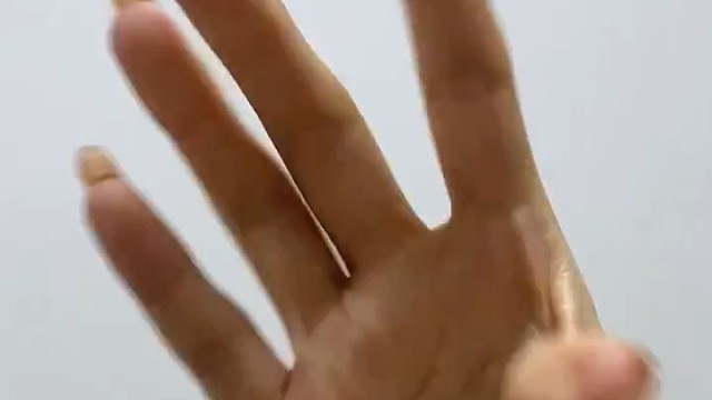 经过一个疗程的治疗，病人的症状明显减轻，手脚的抖动明显减弱，精神状态也得到了明显的改善。