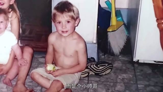 一个全身95%部位被烧伤的年轻人，他是如何生活的？