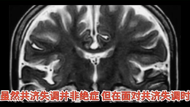 共济失调是不是绝症