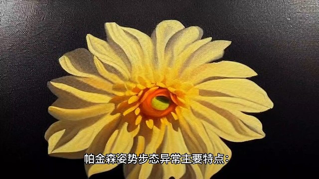 了解一下帕金森吧