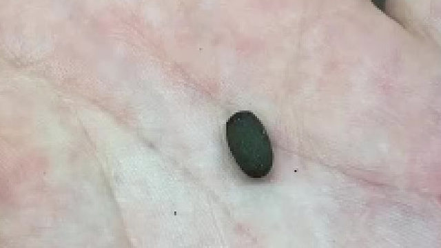 长知识：一些昆虫卵和它的成虫对比……