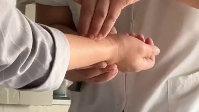 女生体验针灸“穿针”疗法 当事人：很害怕 但真的管用