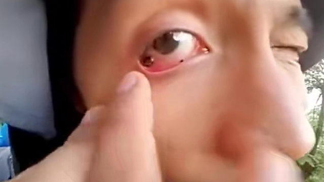 这还不去医院，还在这扣