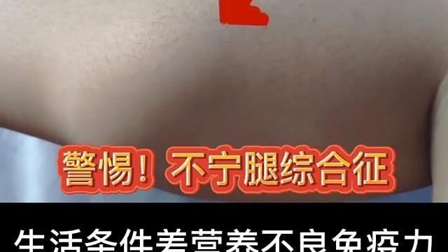 不宁腿综合症是一种神经性疾病，主要表现为下肢不适、刺痛、抽搐和瘙痒等症状，严重影响患者的睡眠和生活质