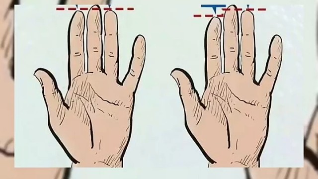 帕金森患者的手指训练