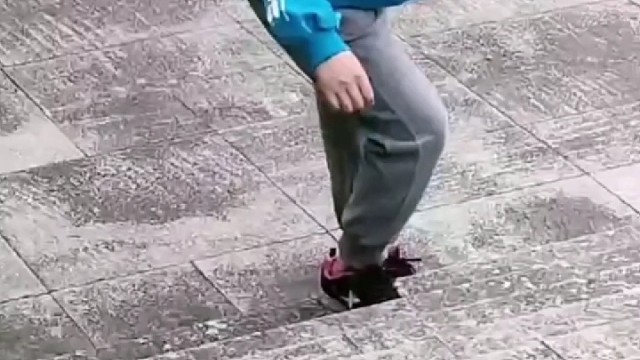 小脑萎缩共济失调