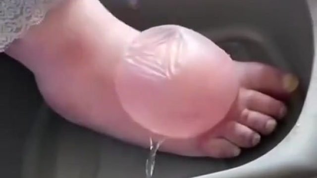 他是怎么忍住不扎的