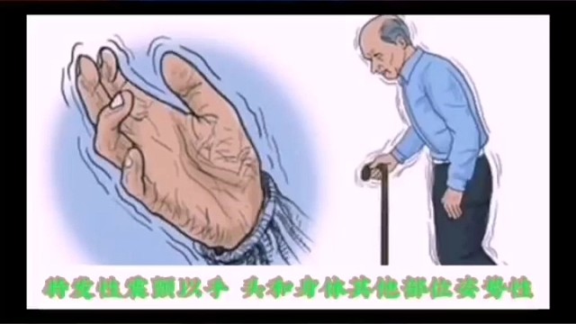 特发性震颤的症状