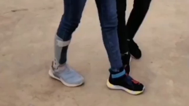 渐进性肌萎缩症(ALS)是一种影响运动神经元的疾病，其原因尚不清楚。它会导致肌肉无力、萎缩，最终导致