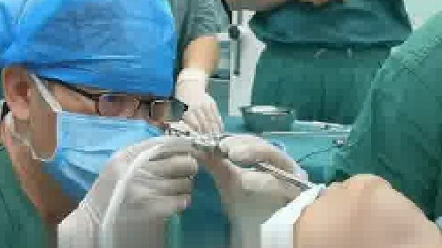 8岁男孩误把笔帽吸入肺部，医生：危险极大，卡的是右肺，一旦滑脱将会阻到左肺。医生全程跪地施救~1