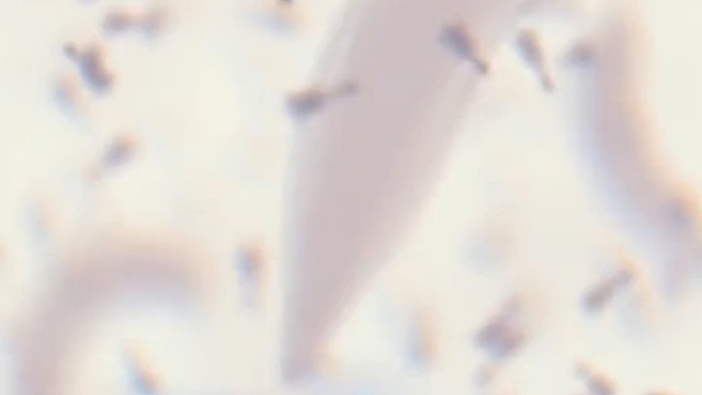 像机械生物的噬菌体，就像是专门为克制细菌的机器人一样。