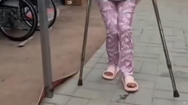 其实对于小脑萎缩这种疾病，西医治疗上并没有什么很好的药物，只能通过一些营养神经类的药物来进行治疗，但