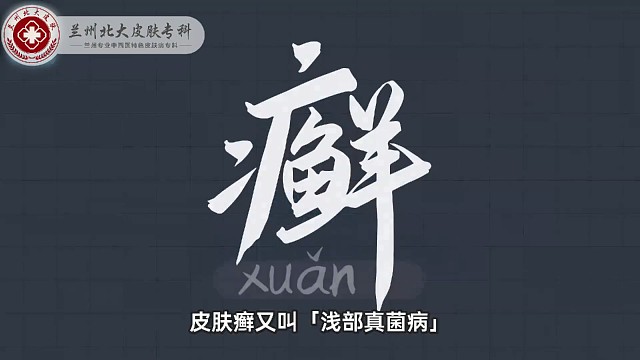 兰州北大皮肤病专家  兰州治疗皮肤癣医院