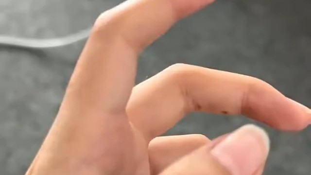 目前，特发性震颤尚无完全根治的方法，但可以通过多种治疗方式控制症状，提高患者的生活质量。