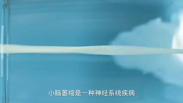 2症状#愿天下更健康更长寿