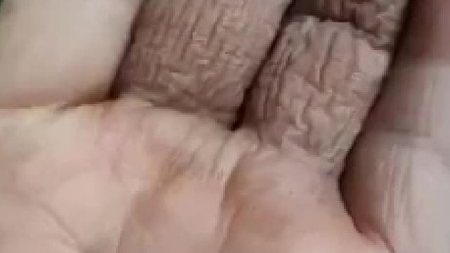 这手指是怎么回事？