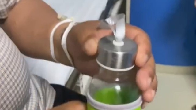 除了手抖，特发性震颤可能伴随头抖、腿抖、紧张激动全身颤抖等情况。