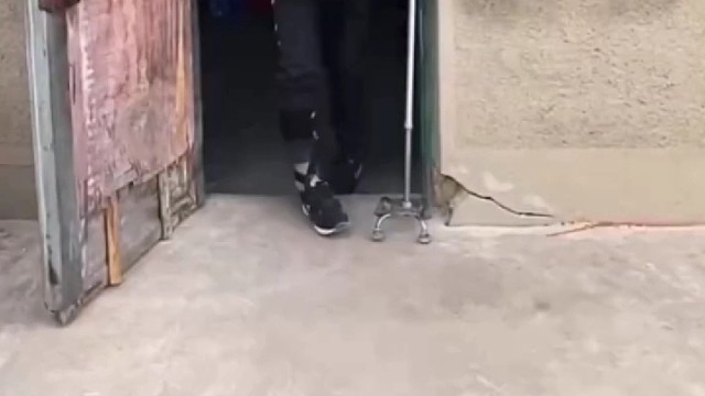 共济失调可改善