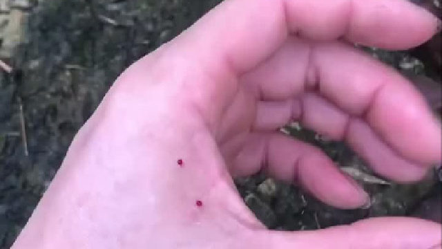 被咬了，下一步我该肿么办啊