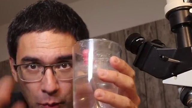 洗澡搓下来的黑泥，究竟是什么，显微镜下放大1000倍让人吃惊02