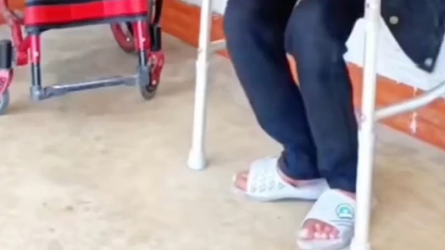 3、运动神经元会导致肢体无力，肌肉紧张和行走困难，这种现象属于上运动神经元的类型，大多数患者在成年之