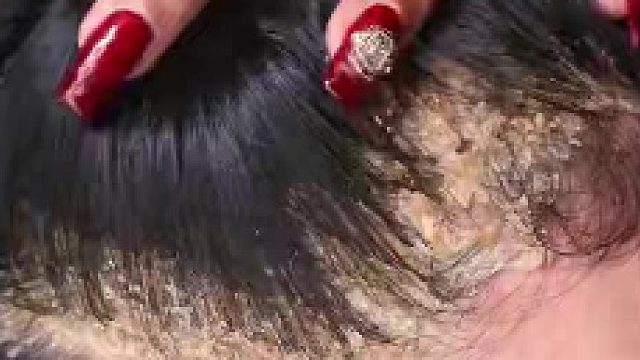 这是掉皮肤碎片吗？