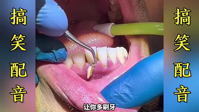 搞笑配音：一个比一个搞笑…这简直就是翻译啊