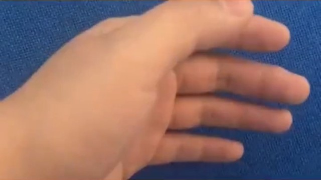 目前，特发性震颤的病因并不完全清楚，但研究表明，它可能与遗传、环境、年龄等因素有关。