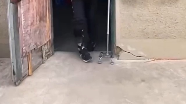 小脑萎缩症的患者，早期的症状还是比较轻的，但是也会给患者带来一定的影响。患者会有步行障碍，也就是患者