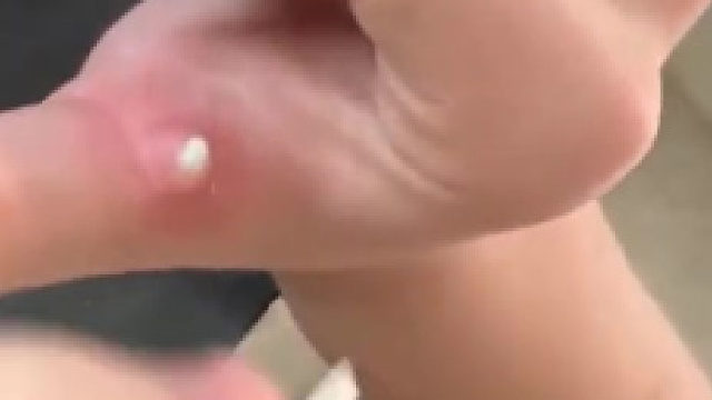 这种鸡皮你们都怎么处理的啊