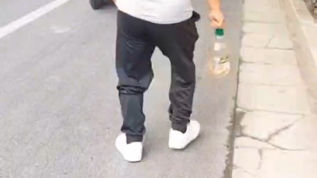 小脑萎缩不用担心，可以治疗