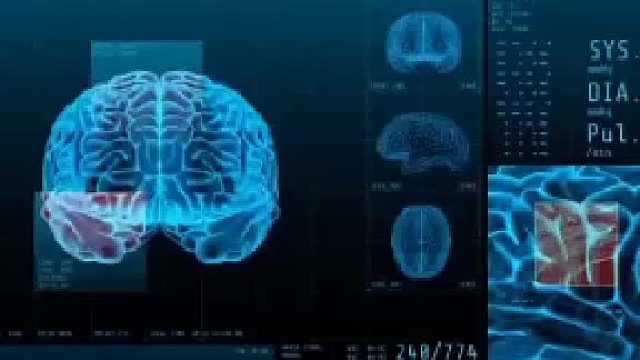 脑鸣的症状无非就是大脑里有声音