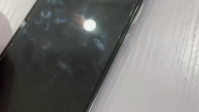 （帕金森综合征）