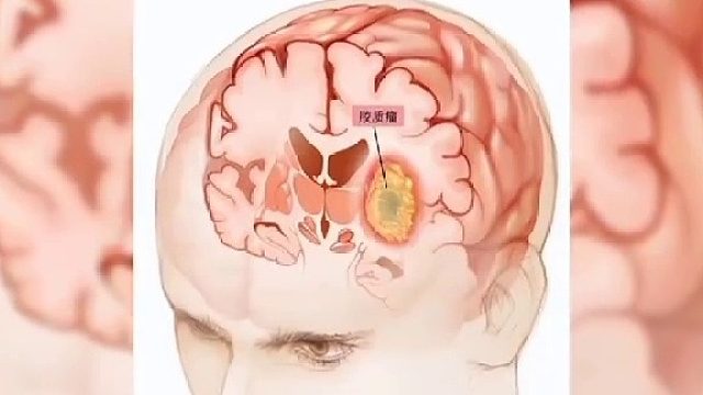 脑鸣、失眠、焦虑该怎么办