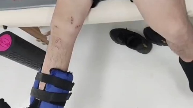 它主要影响人体的运动神经元，导致肌肉功能逐渐丧失，进而引起肌无力和运动障碍。