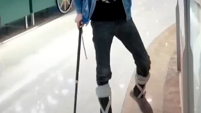 1、运动神经元病的症状主要是肌肉逐渐无力萎缩，最终导致呼吸衰竭，也会因为呼吸肌麻痹而死亡。