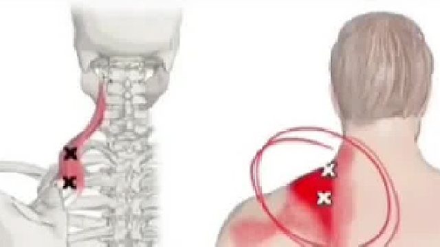 这里经常不舒服的可以这样练，真的很舒服