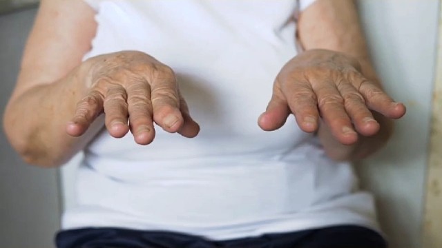 帕金森四大症状是什么？