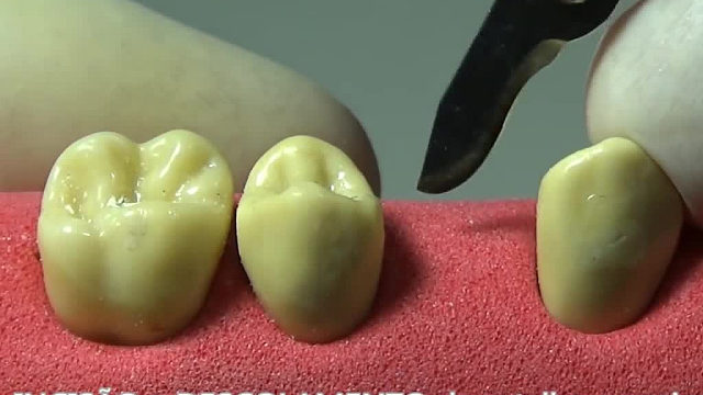 模拟种牙全过程，居然要反反复复做三次小手术，看完以后决定要更加爱护牙齿了。。。