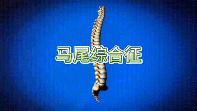 一分钟了解马尾