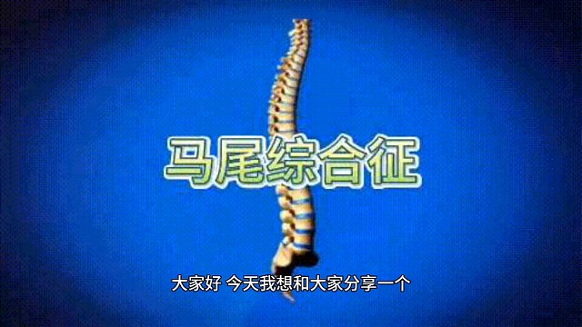 关于马尾神经综合征……