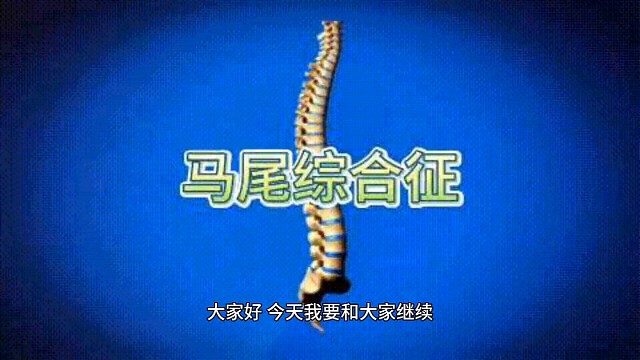 马尾综合征会影响日常生活吗？