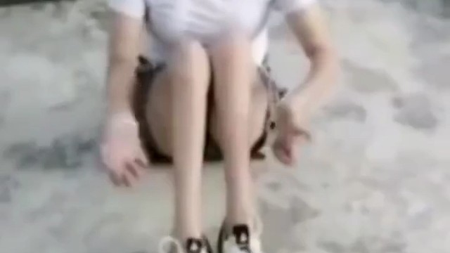 运动神经元病的发病与其他疾病有明显的不同，运动神经元病会导致出现双手等部位的肌肉萎缩，并逐渐向前臂、