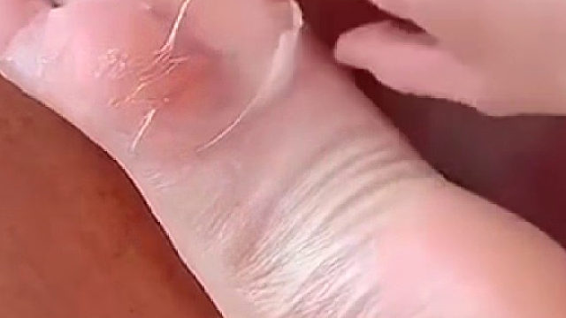 这脚皮看着……