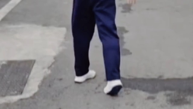 走路异常怎么办？ #肌营养不良 #DMD