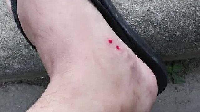 要挂什么科啊？