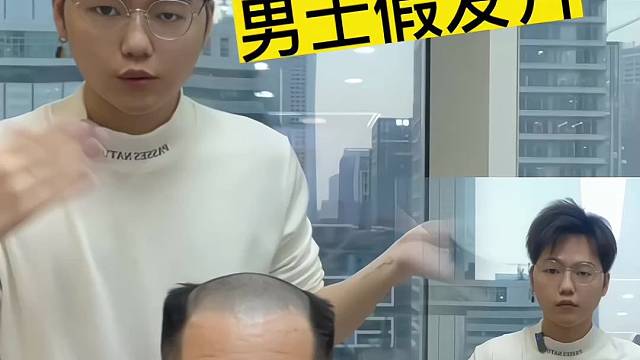 男士假发片之元旦日，快速解决男士脱发困扰，过年不再秃头