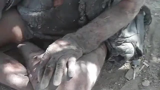 如果一个人1个月不洗澡，身体会发生什么变化，会臭死吗03