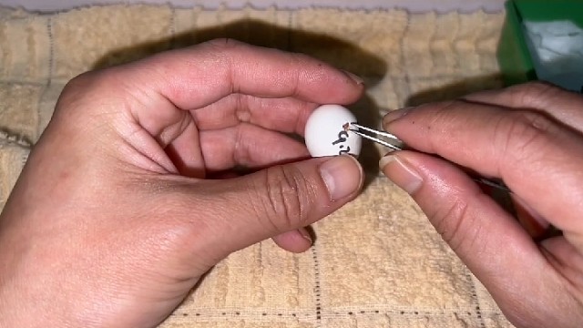 手抖是什么原因导致的