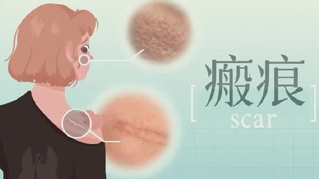 兰州去疤痕哪里比较好